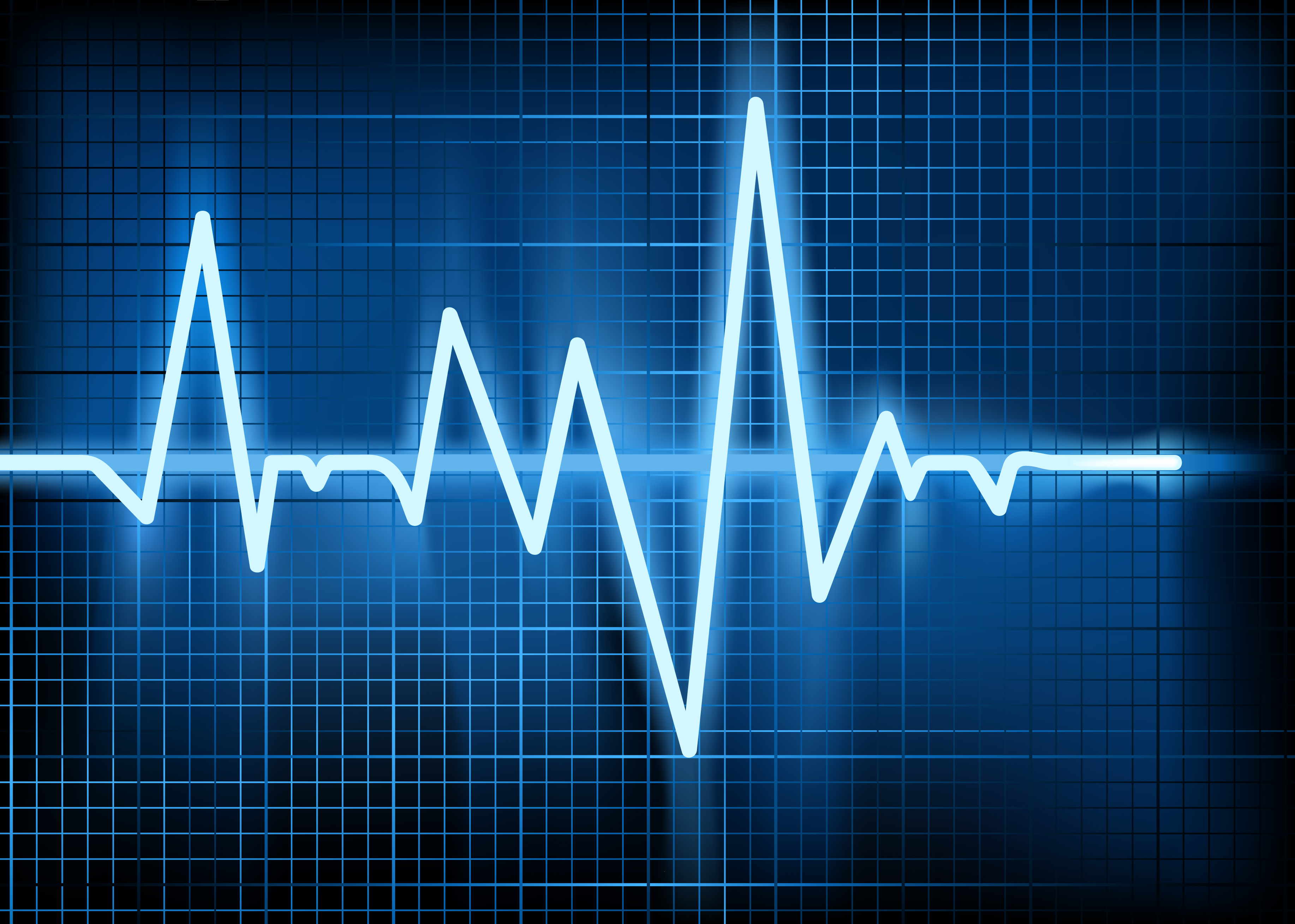 Cardiogram Graph Global Trade Review (GTR)